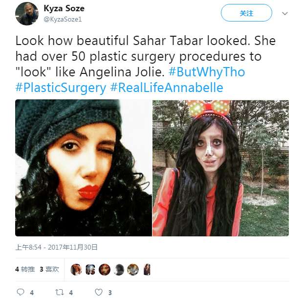 伊朗美女整容变成丧尸