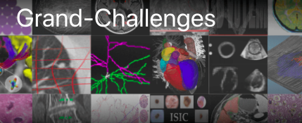 Grand Challenges in Biomedical Image Analysis