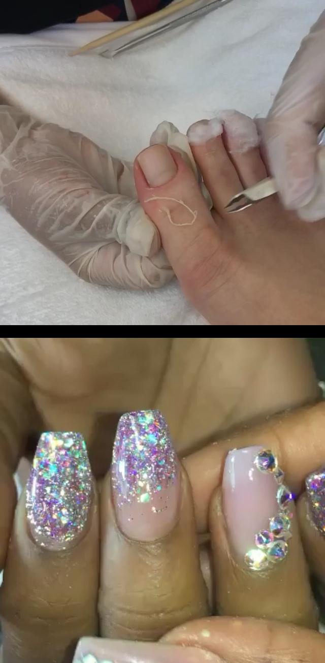 ingrown toenail removal,teal nails,Not Polish, kreationsbykiki , custom , glitter , acrylic , swarovski **Vdetalhado dessa cutilagem e esmaltaestno IGTV** Vcs pediram vinho, enttaEssa cutilagem perfeita nE pense numa misturinha que deu certo foi essa da cor , LicordeCereja com , Sangria da dailus To super apaixonada!  