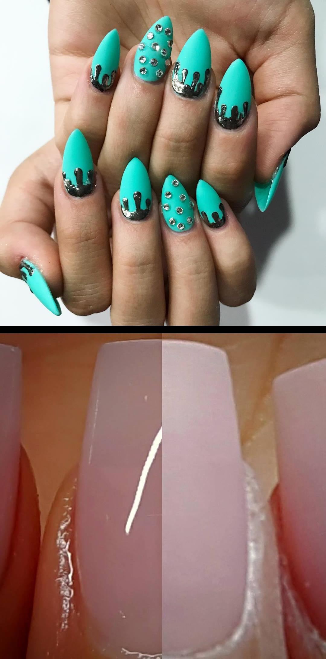 onycholysis,t nails,Las de hoy en menta  Before shiny after shiny gel top products  missuamerica.com  