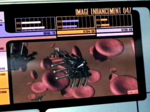 FM144|20200302简短的后续报道