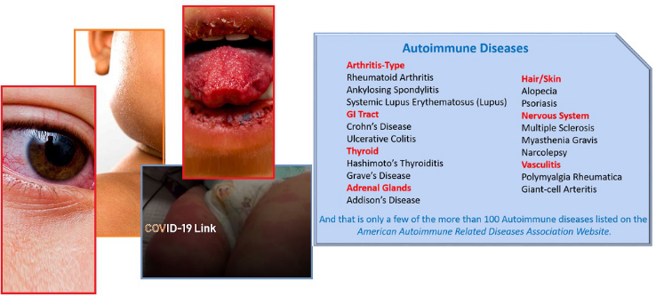 齐塔人之声通讯第712期|2020/05/24 闪光线索,天空辉光,自身免疫冠状病毒,自身免疫性疾病