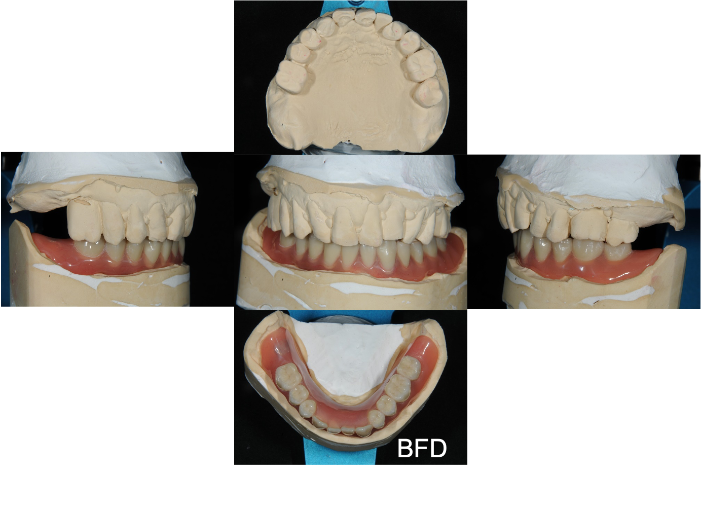 PBR 牙齿 口腔 人体模型 医用牙齿口腔 舌头 牙齿 牙龈 牙床-cg模型免费下载-CG99